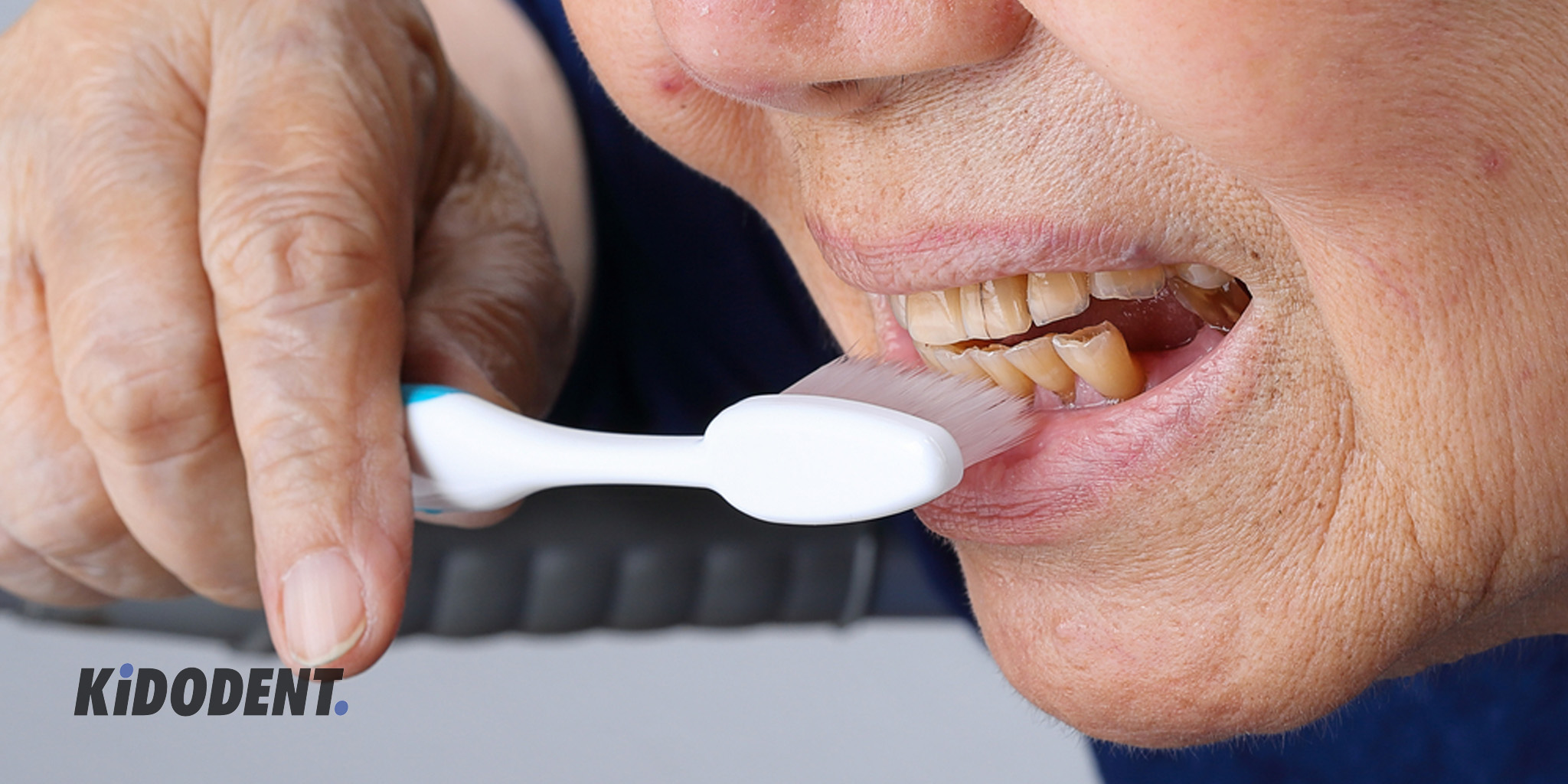 فرسایش دندان: علائم، علل و درمان های رایج