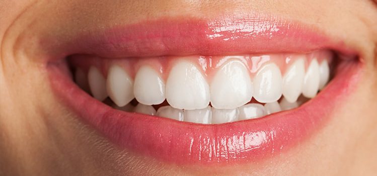 ارتودنسی – کلینیک دندانپزشکی ایده آل
