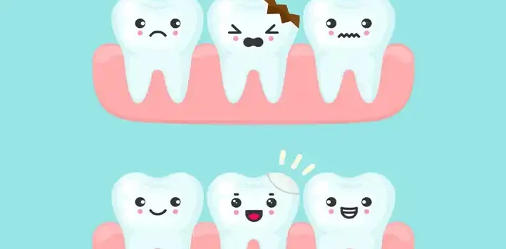دندان بریده شده: علل و گزینه های درمان