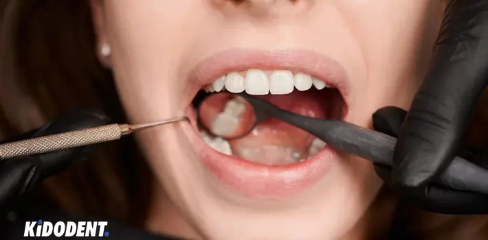 دندان ترک خورده: علائم، انواع و درمان